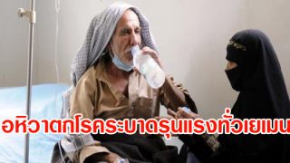 ทดสอบหนัก! นอกจากพิษสงครามแล้ว อหิวาตกโรคระบาดยังรุนแรงทั่วเยเมน