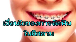 เงื่อนไขของการจัดฟัน ตามหลักการอิสลาม