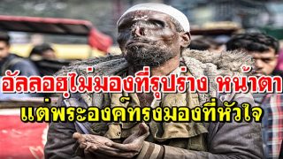 อัลลอฮฺไม่มองที่รุปร่าง หน้าตา แต่พระองค์ทรงมองที่หัวใจ
