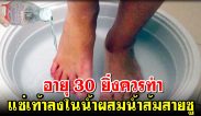 อายุ 30 ยิ่งควรทำ แช่เท้าลงในน้ำผสมน้ำส้มสายชู 2 ช้อนโต๊ะ เหนื่อยเมื่อยล้าจะหายเลย