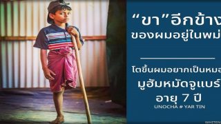 มูฮัมหมัดจูแบร์ อายุ 7 ปี ถูกทหารพม่าทำร้าย เสียขาหนึ่งข้าง