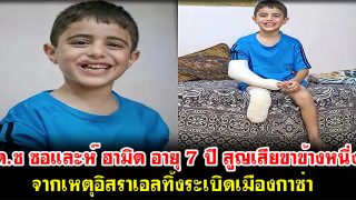 ด.ช ซอและห์ ฮามิด อายุ 7 ปี สูญเสียขาข้างหนึ่ง จากเหตุอิสราเอลทิ้งระเบิดเมืองกาซ่า