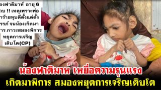 ร่วมช่วยเหลือน้องฟาติมาห์ เหยื่อความรุนแรง เกิดมาพิการ สมองหยุดการเจริญเติบโต